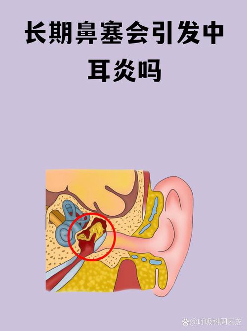 免费听力测试