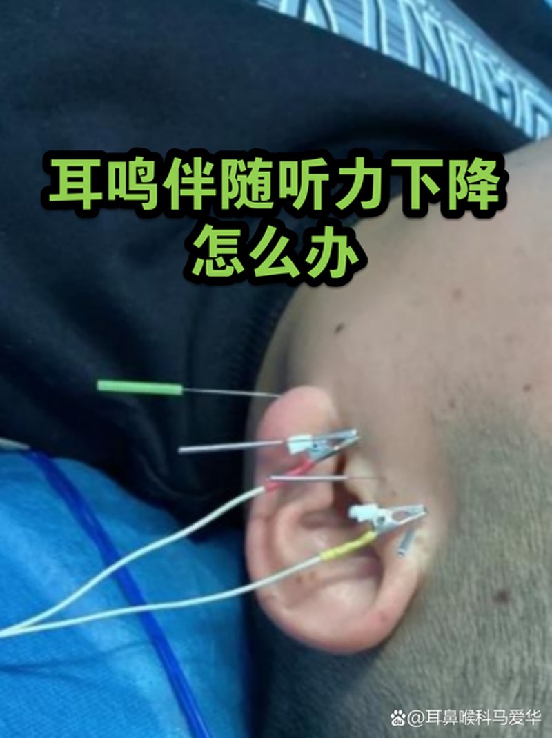 新生儿听力筛查：守护宝宝成长的第一步